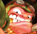 worms icon